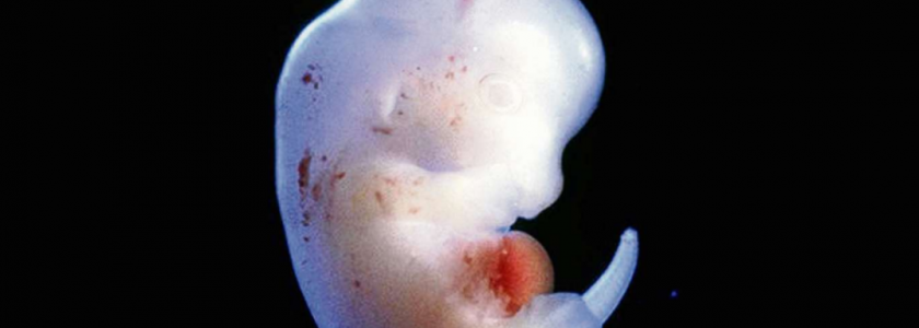 The BORG – Made In Tokyo & Berlin: Human Organs Grown On Animals